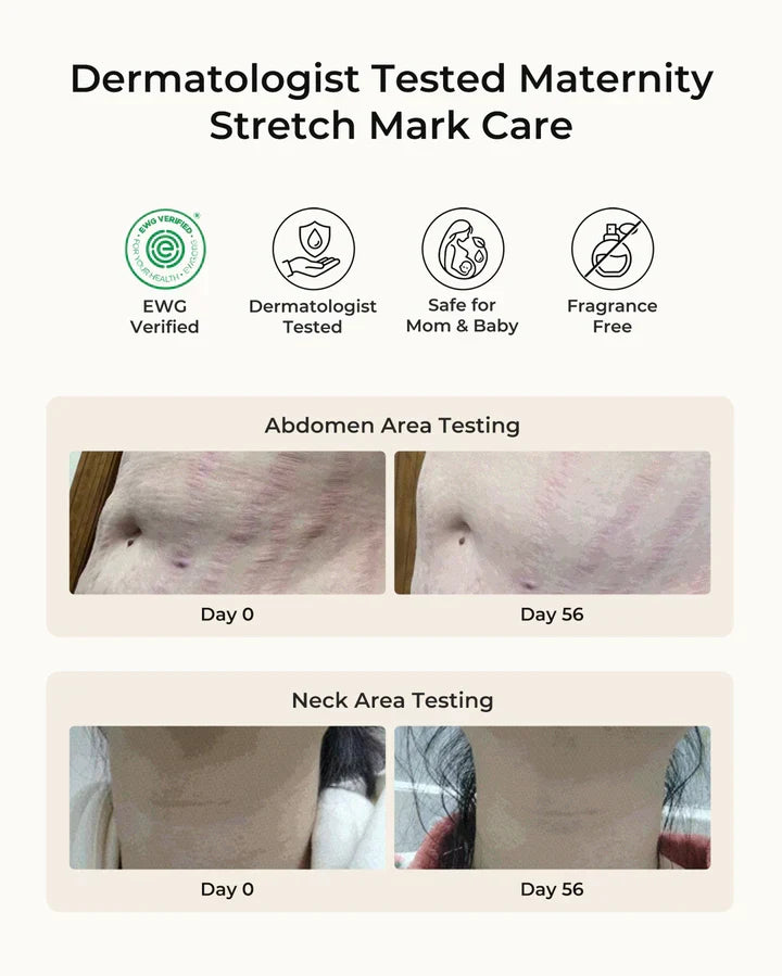 Momcozy Pro-Collagen Belly Moisturizer – Krem Hidratues për Barkun gjatë Shtatzënisë