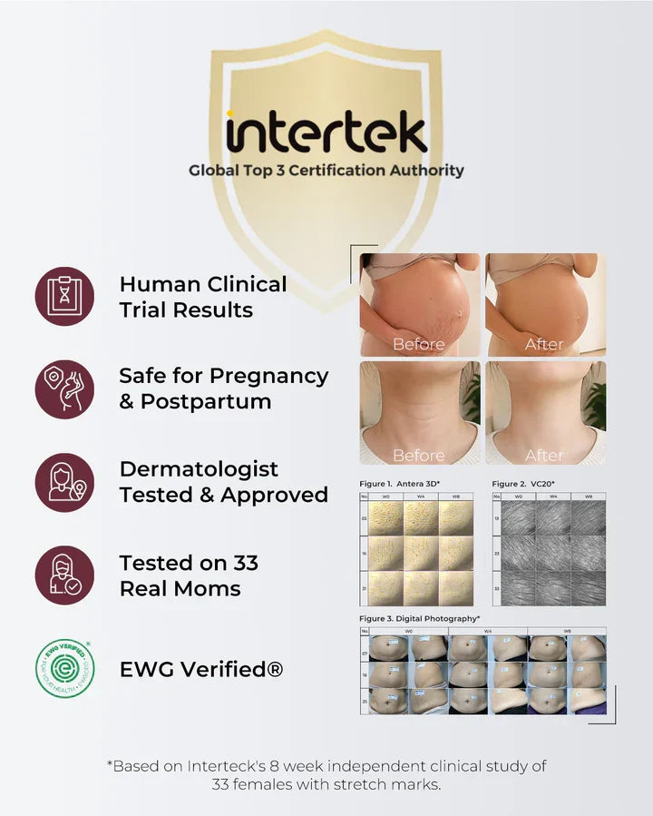 Momcozy Pro-Collagen Belly Moisturizer – Krem Hidratues për Barkun gjatë Shtatzënisë