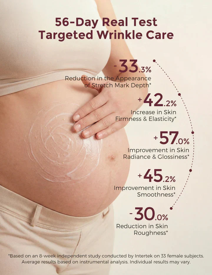 Momcozy Pro-Collagen Belly Moisturizer – Krem Hidratues për Barkun gjatë Shtatzënisë