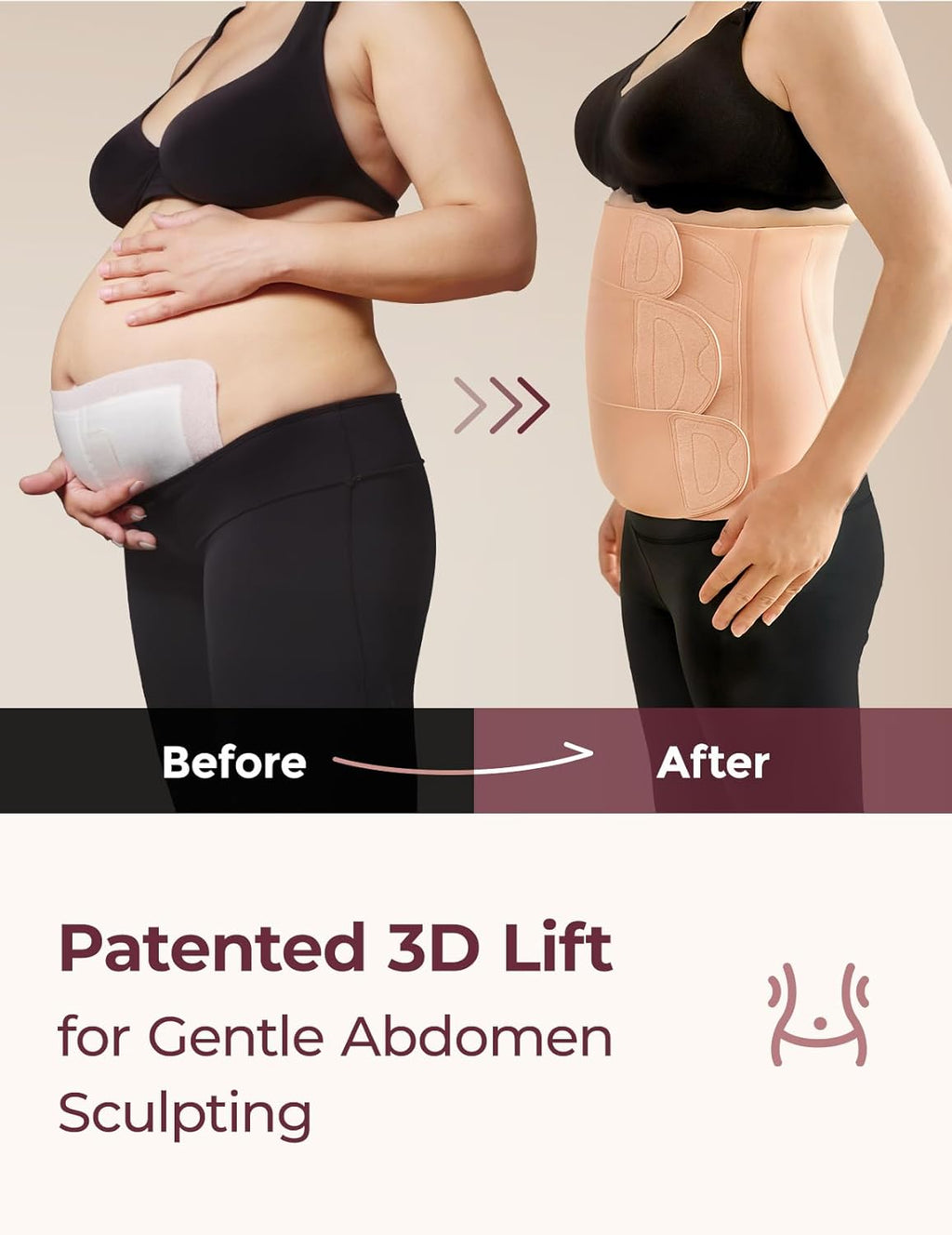 Momcozy Ergowrap Standard – Korset mbështetës pas lindjes me dizajn ergonomik dhe material të frymëmarrshëm