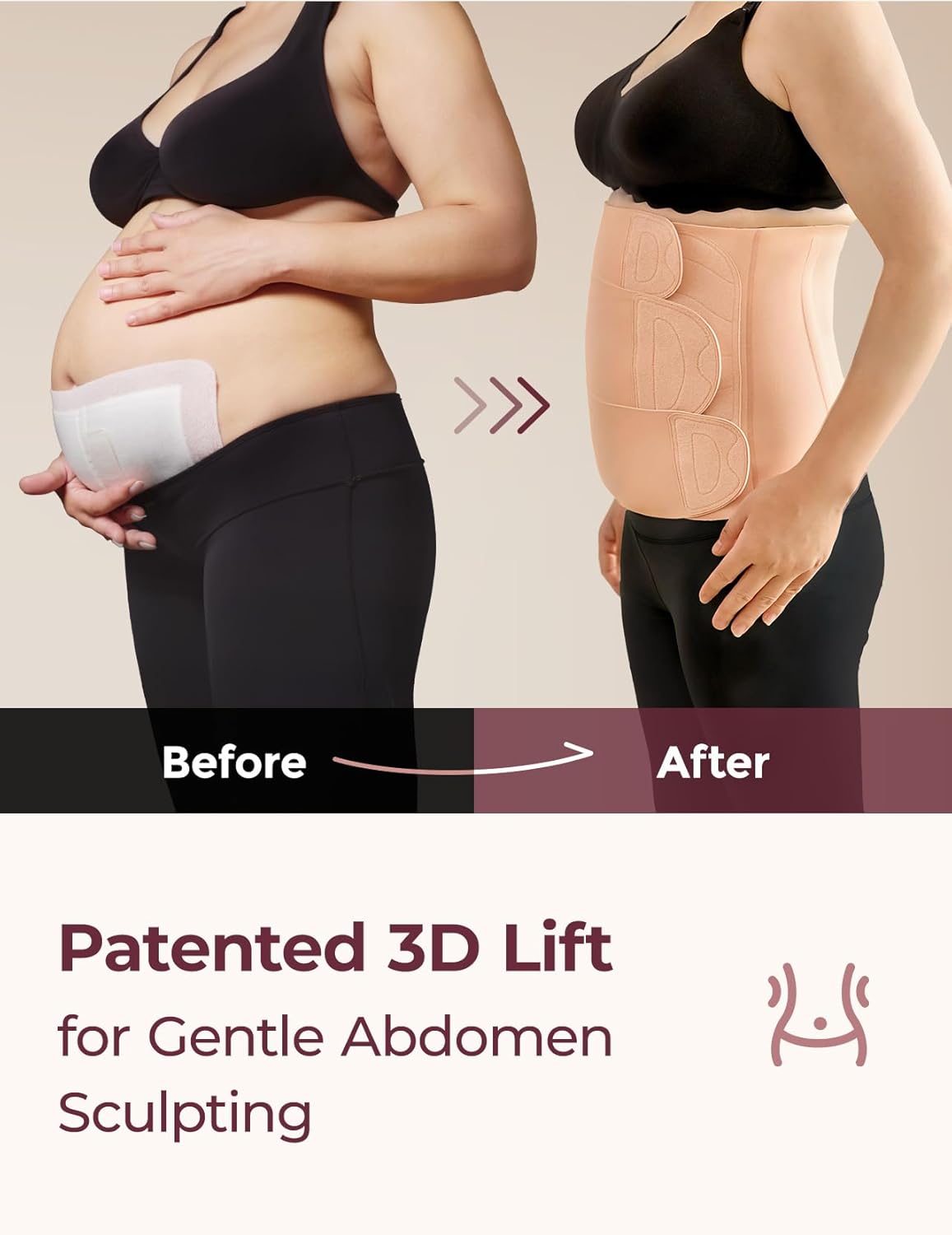 Momcozy Ergowrap Standard – Korset mbështetës pas lindjes me dizajn ergonomik dhe material të frymëmarrshëm