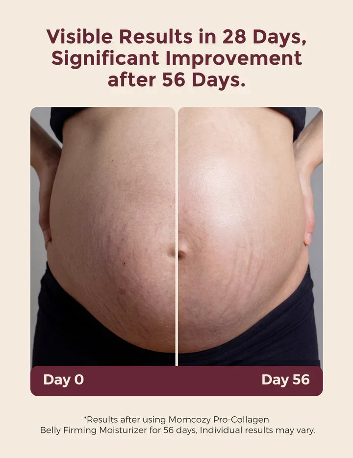 Momcozy Pro-Collagen Belly Moisturizer – Krem Hidratues për Barkun gjatë Shtatzënisë