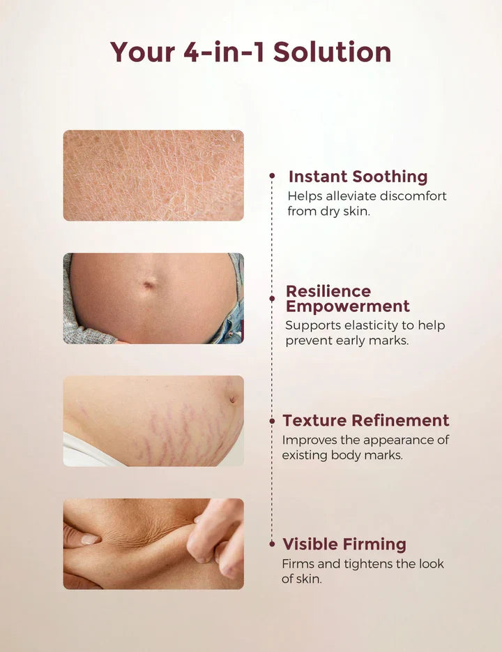 Momcozy Pro-Collagen Belly Moisturizer – Krem Hidratues për Barkun gjatë Shtatzënisë